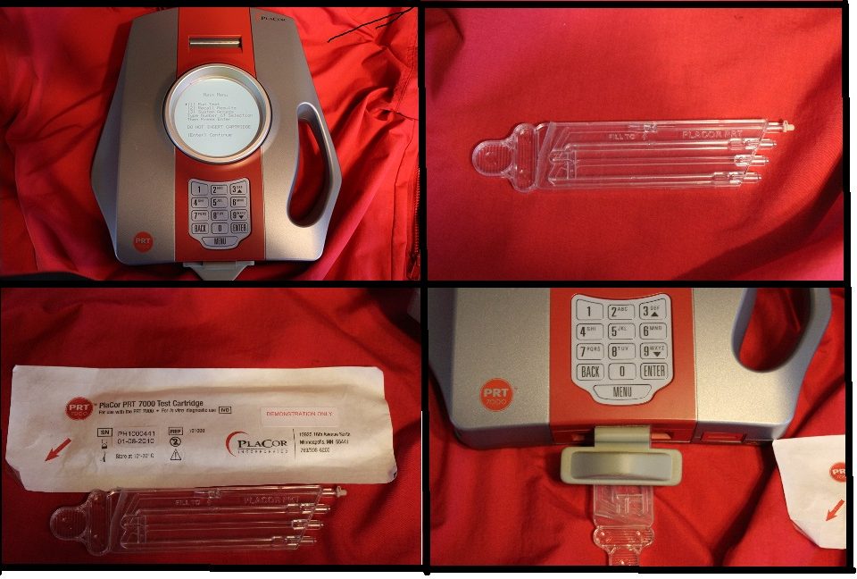 PlaCor Device to measure Platelet activity without reagents from a single finger stick of blood